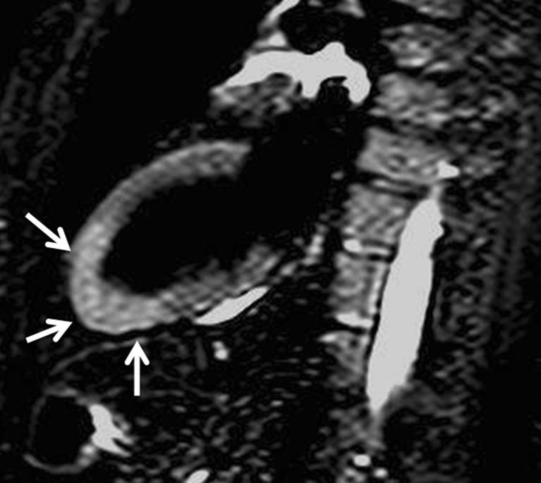 https://cdn.ncbi.nlm.nih.gov/pmc/blobs/72c6/3289013/8ce4f8fc2029/13244_2011_91_Fig7_HTML.jpg