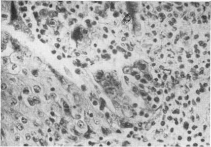 https://cdn.ncbi.nlm.nih.gov/pmc/blobs/72c7/2012485/04b54d565e9e/archdisch01612-0065-a.jpg
