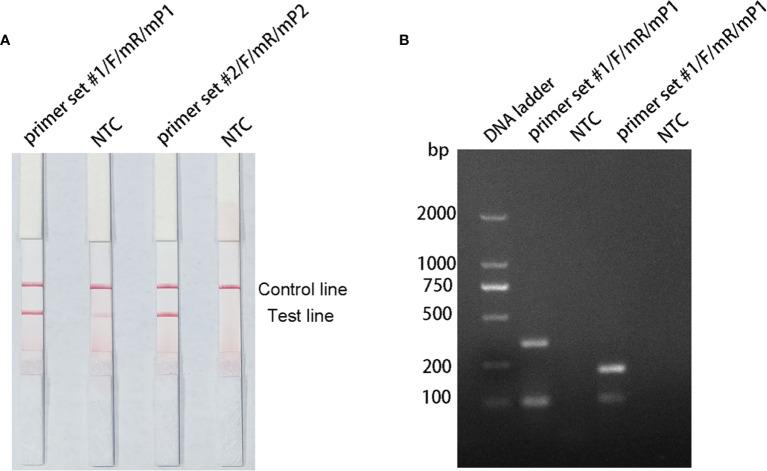 https://cdn.ncbi.nlm.nih.gov/pmc/blobs/72ca/9174636/a0fcb0c77308/fcimb-12-895261-g004.jpg