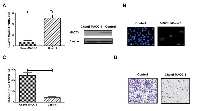 https://cdn.ncbi.nlm.nih.gov/pmc/blobs/72cf/5865862/d80f70b1d722/mmr-16-05-7329-g01.jpg