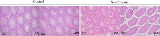 https://cdn.ncbi.nlm.nih.gov/pmc/blobs/72f5/10188089/217953b898fd/VMS3-9-1304-g006.jpg