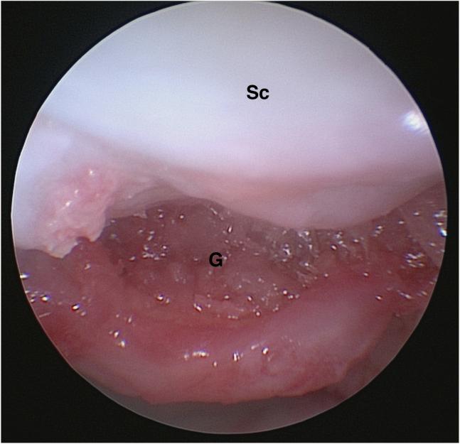 https://cdn.ncbi.nlm.nih.gov/pmc/blobs/72fe/8719304/d8612a1b9adc/gr5.jpg