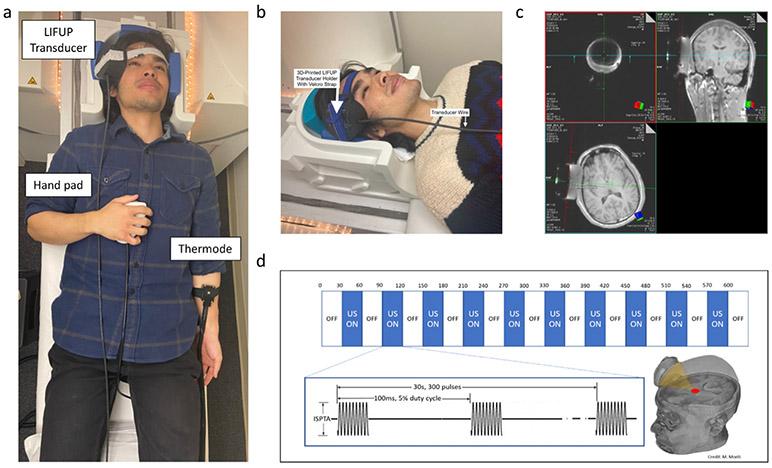 https://cdn.ncbi.nlm.nih.gov/pmc/blobs/7303/7888561/1f04cfd36956/nihms-1666632-f0002.jpg