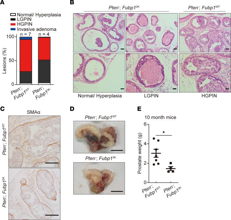 https://cdn.ncbi.nlm.nih.gov/pmc/blobs/7305/11405040/b44cc4da9745/jci-134-175023-g095.jpg