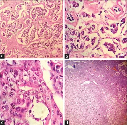 https://cdn.ncbi.nlm.nih.gov/pmc/blobs/7305/6259294/ebba018c63da/IJABMR-8-210-g001.jpg