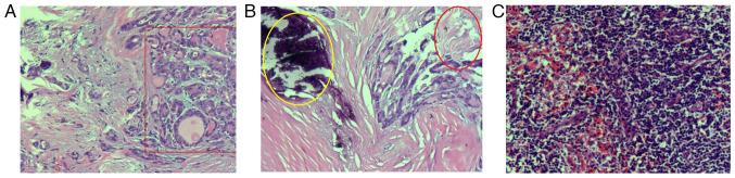 https://cdn.ncbi.nlm.nih.gov/pmc/blobs/730b/11775643/9ac4d306dcfd/br-22-03-01926-g02.jpg