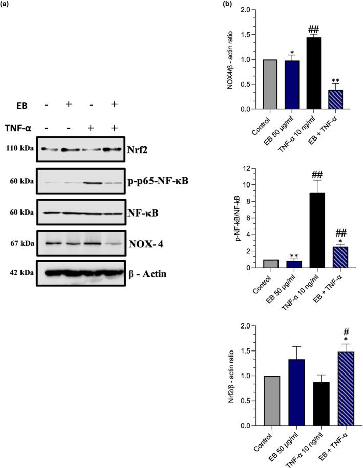 https://cdn.ncbi.nlm.nih.gov/pmc/blobs/730c/10345675/968f77095554/FSN3-11-4047-g007.jpg