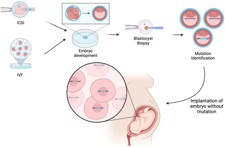 https://cdn.ncbi.nlm.nih.gov/pmc/blobs/7312/12034866/2d899499f017/gr1.jpg