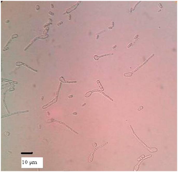 https://cdn.ncbi.nlm.nih.gov/pmc/blobs/7313/4909865/8129b488ea37/gr4.jpg
