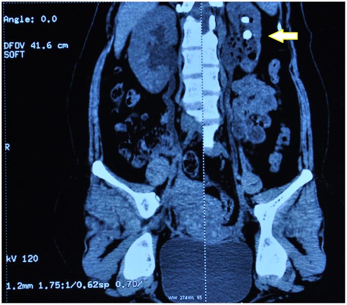 https://cdn.ncbi.nlm.nih.gov/pmc/blobs/7313/4909865/ec1d8c840428/gr1.jpg