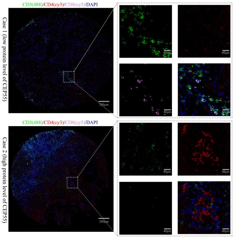 https://cdn.ncbi.nlm.nih.gov/pmc/blobs/7314/12080573/a790c4397065/ijmsv22p2446g007.jpg