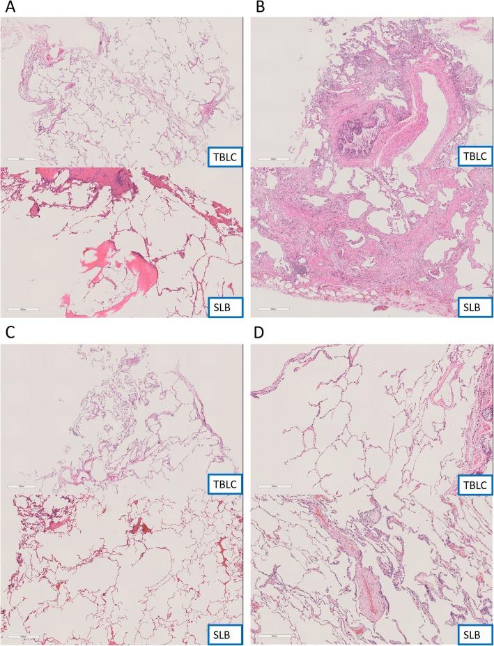 https://cdn.ncbi.nlm.nih.gov/pmc/blobs/7320/6892217/e0fabcae520f/13000_2019_908_Fig1_HTML.jpg