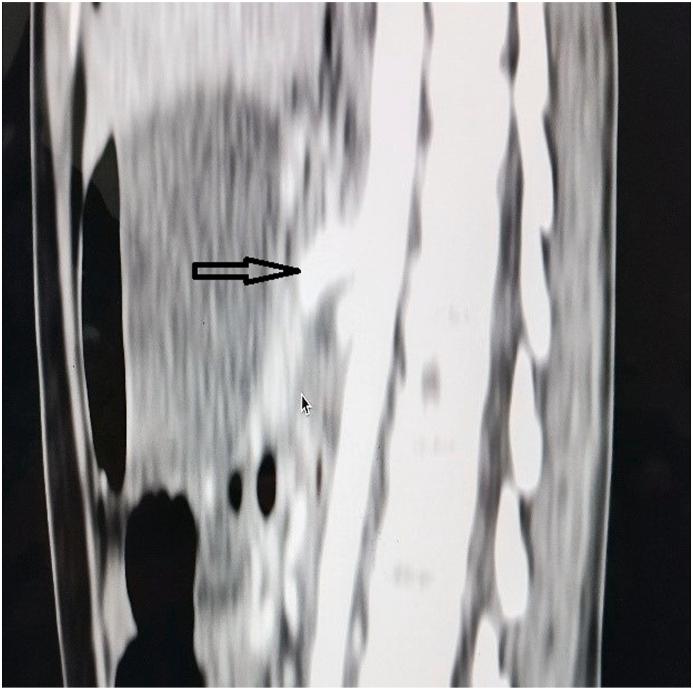 https://cdn.ncbi.nlm.nih.gov/pmc/blobs/7321/9442331/f2ef306cbfdc/gr2.jpg
