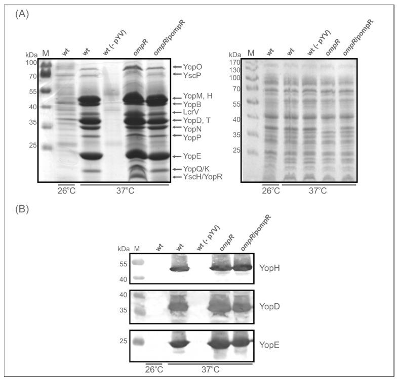 https://cdn.ncbi.nlm.nih.gov/pmc/blobs/7324/9100119/03f6edaa9eef/ijms-23-04758-g004.jpg
