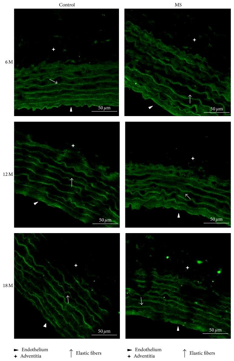 https://cdn.ncbi.nlm.nih.gov/pmc/blobs/7326/4886055/0268a6da315e/IJHY2016-5830192.003.jpg