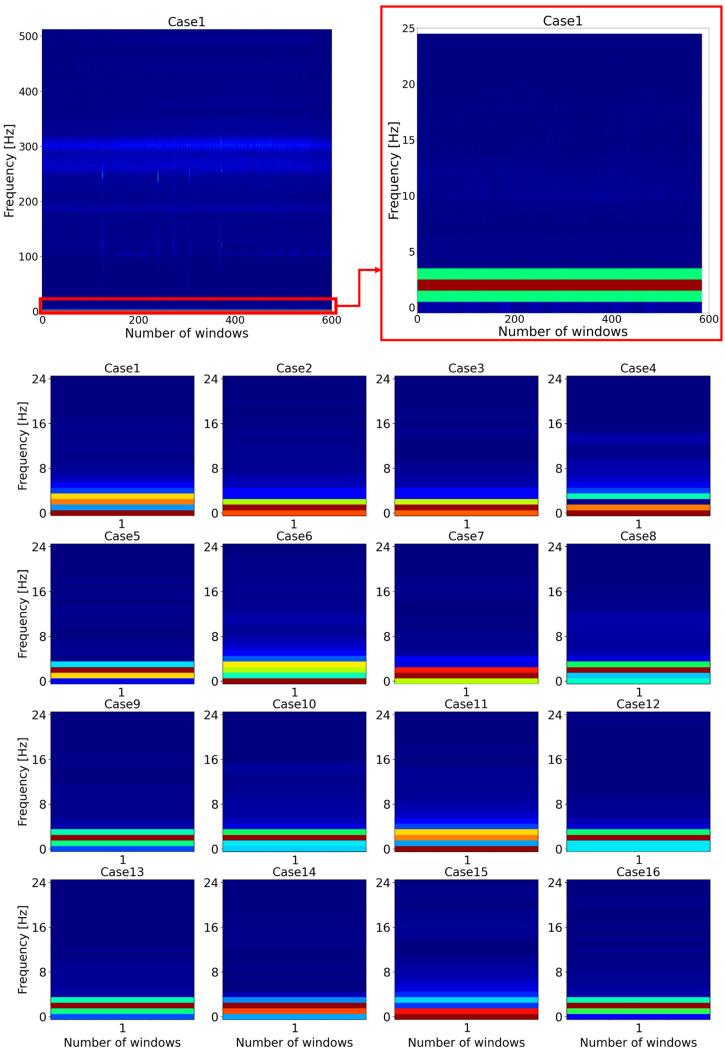 https://cdn.ncbi.nlm.nih.gov/pmc/blobs/732b/8840181/0cf38da72e2f/sensors-22-01210-g007.jpg