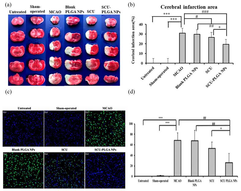 https://cdn.ncbi.nlm.nih.gov/pmc/blobs/7330/10535132/e78ca43394fe/pharmaceutics-15-02322-g004.jpg