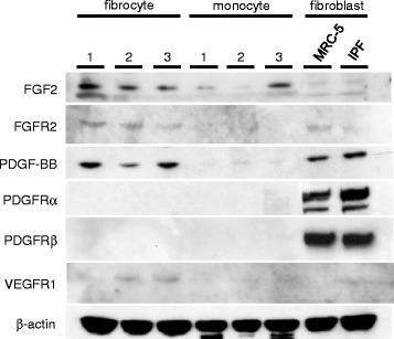 https://cdn.ncbi.nlm.nih.gov/pmc/blobs/7331/5603061/b50cb486babe/12931_2017_654_Fig2_HTML.jpg