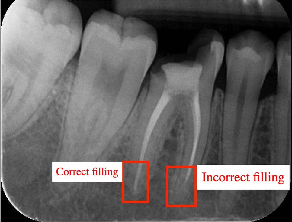 https://cdn.ncbi.nlm.nih.gov/pmc/blobs/7334/12007342/3ce058a25bc5/40001_2025_2331_Fig2_HTML.jpg