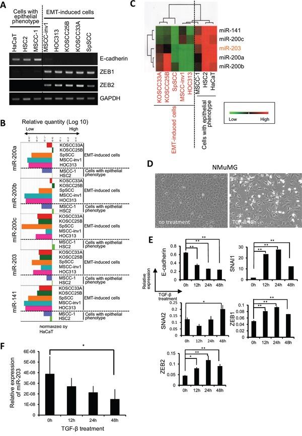 https://cdn.ncbi.nlm.nih.gov/pmc/blobs/7334/4884988/693396a2df3c/oncotarget-07-8223-g002.jpg