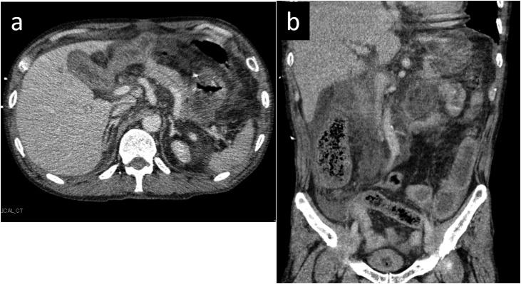 https://cdn.ncbi.nlm.nih.gov/pmc/blobs/7334/6664165/bc5869186a0c/gr1.jpg