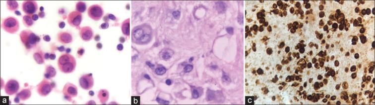 https://cdn.ncbi.nlm.nih.gov/pmc/blobs/733a/11108034/92e45ef2258d/JCytol-41-96-g003.jpg