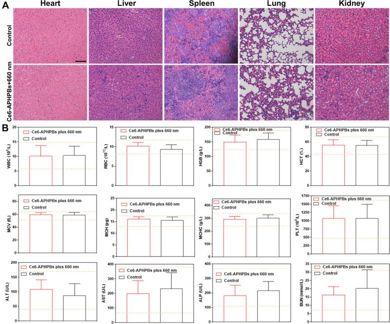 https://cdn.ncbi.nlm.nih.gov/pmc/blobs/7344/8964450/5eabe8c983b9/IJN-17-1397-g0006.jpg