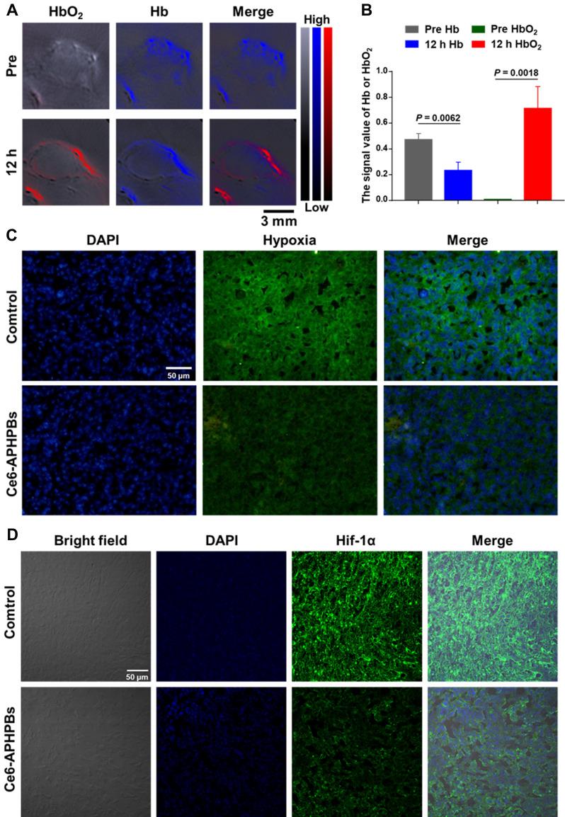 https://cdn.ncbi.nlm.nih.gov/pmc/blobs/7344/8964450/fcabf3b4f9e9/IJN-17-1397-g0004.jpg