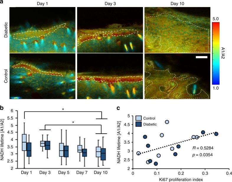 https://cdn.ncbi.nlm.nih.gov/pmc/blobs/7346/6242983/0fee6900ee18/42003_2018_206_Fig5_HTML.jpg