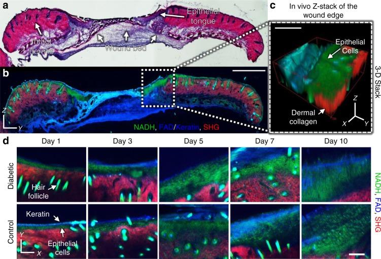 https://cdn.ncbi.nlm.nih.gov/pmc/blobs/7346/6242983/906b2670a68f/42003_2018_206_Fig1_HTML.jpg