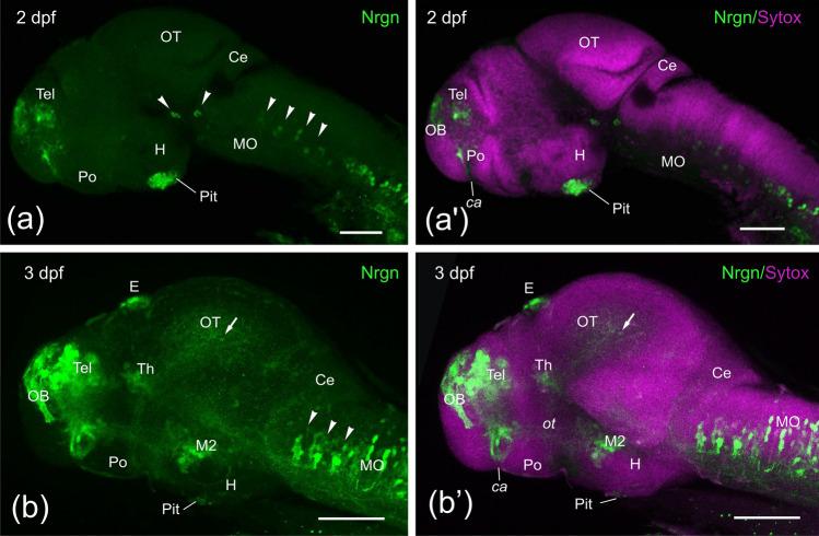 https://cdn.ncbi.nlm.nih.gov/pmc/blobs/7348/9618489/6d1fcc1ff19b/429_2022_2550_Fig1_HTML.jpg