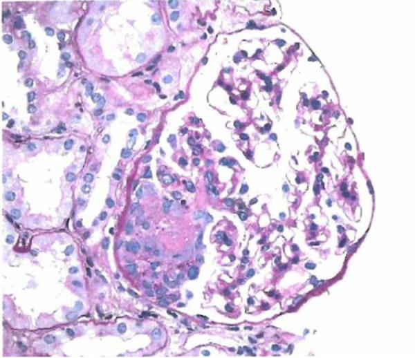 https://cdn.ncbi.nlm.nih.gov/pmc/blobs/734b/7733149/d912d62058b6/amjcaserep-21-e925200-g003.jpg