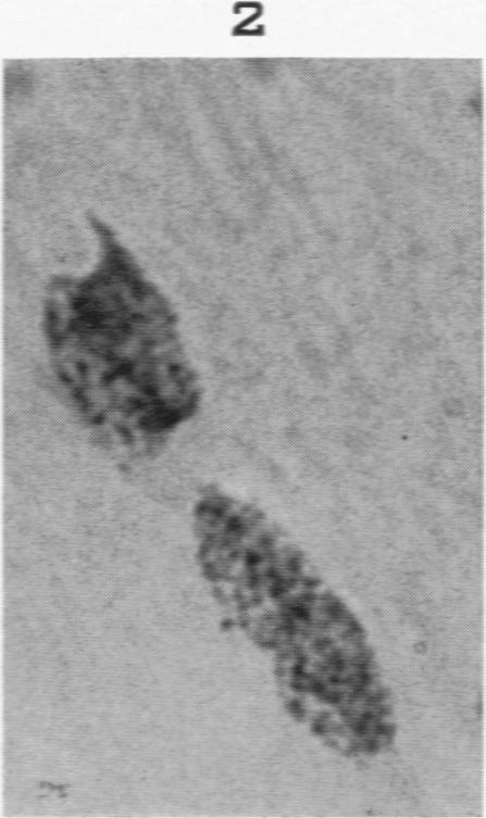 https://cdn.ncbi.nlm.nih.gov/pmc/blobs/734d/1942475/5c420767e979/amjpathol00702-0199-b.jpg