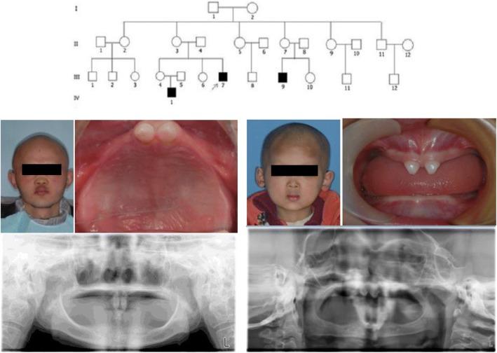 https://cdn.ncbi.nlm.nih.gov/pmc/blobs/734f/6286515/a7d67f0790f7/12881_2018_726_Fig1_HTML.jpg