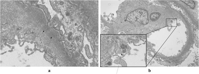 https://cdn.ncbi.nlm.nih.gov/pmc/blobs/7353/6820642/3aeee0d91c10/13730_2019_412_Fig2_HTML.jpg