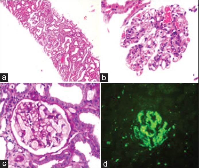 https://cdn.ncbi.nlm.nih.gov/pmc/blobs/736f/4753742/41b3c045289d/IJN-26-45-g002.jpg