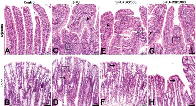 https://cdn.ncbi.nlm.nih.gov/pmc/blobs/7376/11994222/bd7247058fc9/j_abm-2025-0006_fig_006.jpg
