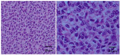 https://cdn.ncbi.nlm.nih.gov/pmc/blobs/7378/3490972/b70e41cdfef4/1477-7819-10-185-5.jpg