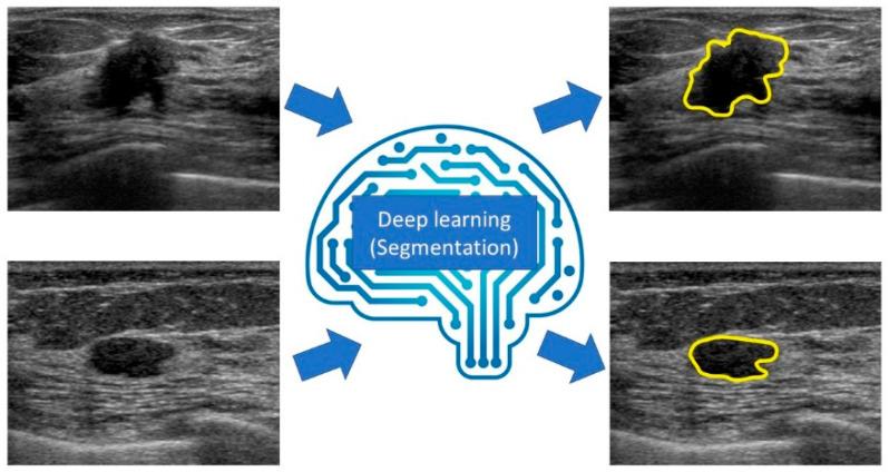 https://cdn.ncbi.nlm.nih.gov/pmc/blobs/7378/7762151/f696ab1b84fb/diagnostics-10-01055-g006.jpg