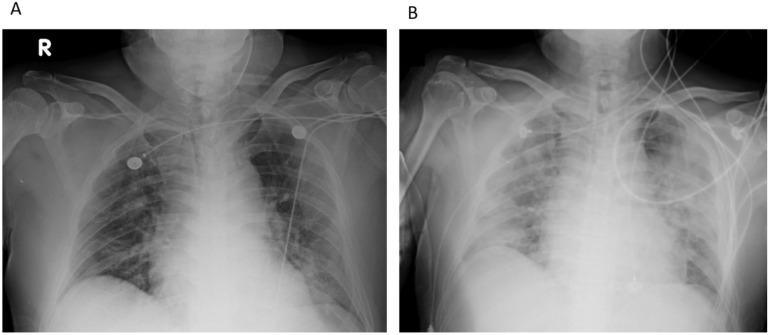 https://cdn.ncbi.nlm.nih.gov/pmc/blobs/737e/9026544/b8e6f41e13eb/jof-08-00339-g001.jpg
