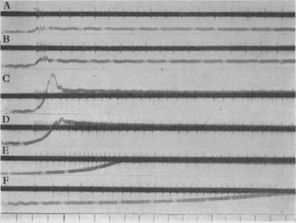 https://cdn.ncbi.nlm.nih.gov/pmc/blobs/7389/1394907/1c12f804e90a/jphysiol01625-0020-a.jpg