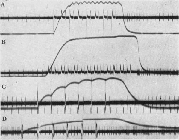 https://cdn.ncbi.nlm.nih.gov/pmc/blobs/7389/1394907/efb22d8a649a/jphysiol01625-0030-a.jpg