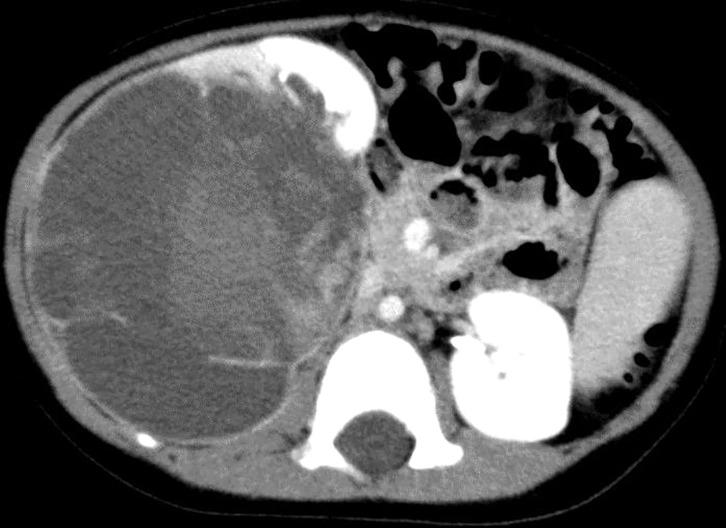 https://cdn.ncbi.nlm.nih.gov/pmc/blobs/738d/12375878/845a76796200/scr-11-01-25-0010-g002.jpg