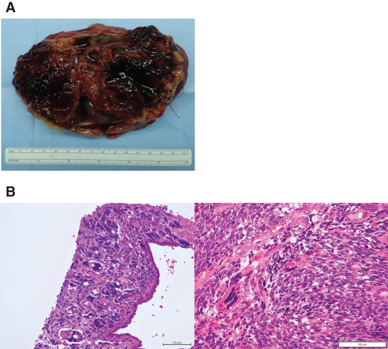 https://cdn.ncbi.nlm.nih.gov/pmc/blobs/738d/12375878/b7439a004309/scr-11-01-25-0010-g003.jpg