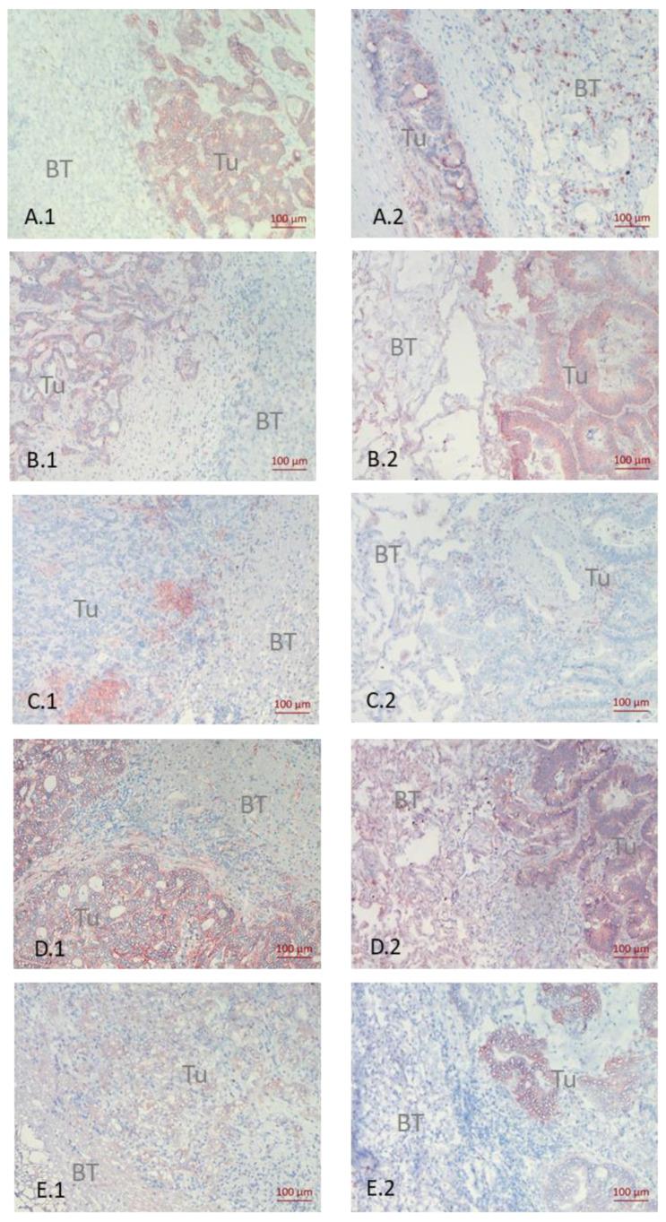 https://cdn.ncbi.nlm.nih.gov/pmc/blobs/738d/9027562/9c1bfaa477b7/cancers-14-01939-g002.jpg