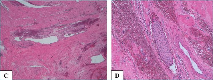 https://cdn.ncbi.nlm.nih.gov/pmc/blobs/738e/10688248/b07007a2ed55/pathol-2023-04-232-g002.jpg