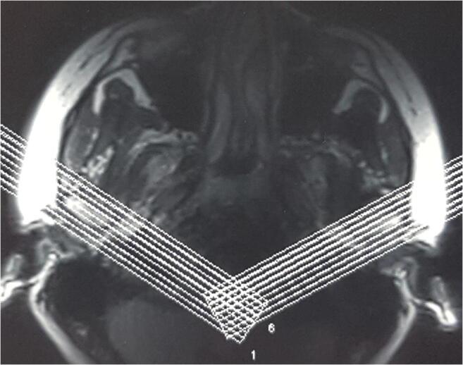 https://cdn.ncbi.nlm.nih.gov/pmc/blobs/7394/7785556/5855fb5f0285/784_2020_3347_Fig2_HTML.jpg
