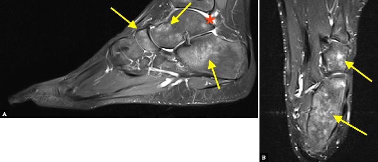 https://cdn.ncbi.nlm.nih.gov/pmc/blobs/73a0/10494807/9532b32b777a/j_jou.2023.0019_fig_005.jpg