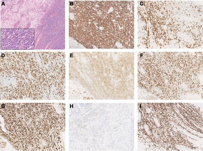 https://cdn.ncbi.nlm.nih.gov/pmc/blobs/73a4/8053605/0683ee1d9637/OTT-14-2489-g0002.jpg