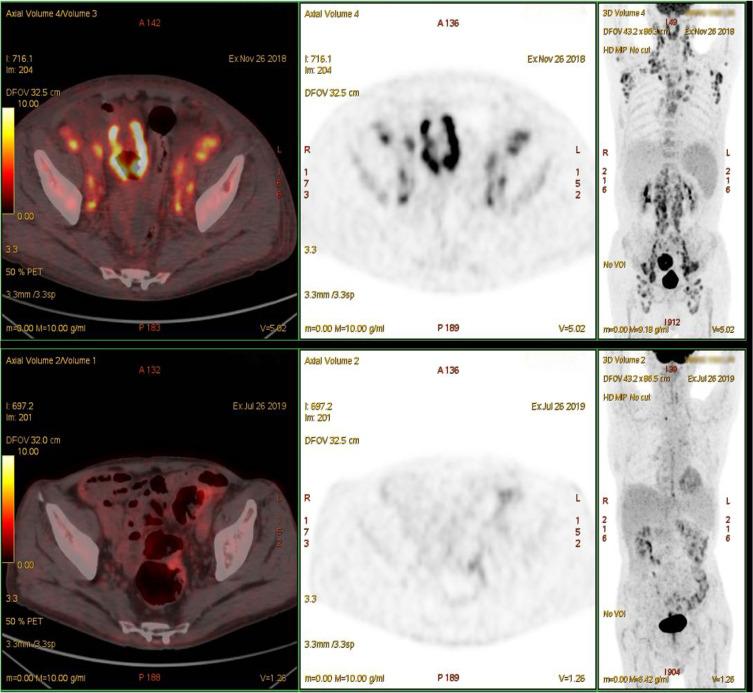 https://cdn.ncbi.nlm.nih.gov/pmc/blobs/73a4/8053605/3361ef8b80d9/OTT-14-2489-g0003.jpg